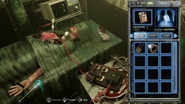 開胸された女性 開胸された女性