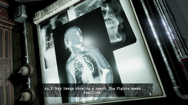 X 線画像 X 線画像