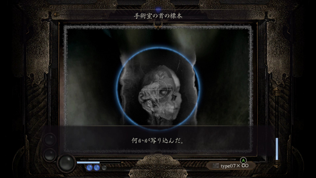 地縛霊「手術室の首の標本」 地縛霊「手術室の首の標本」